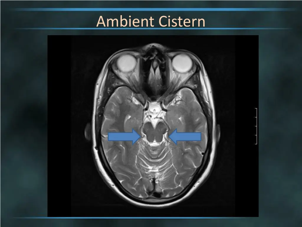 ambient cistern 3