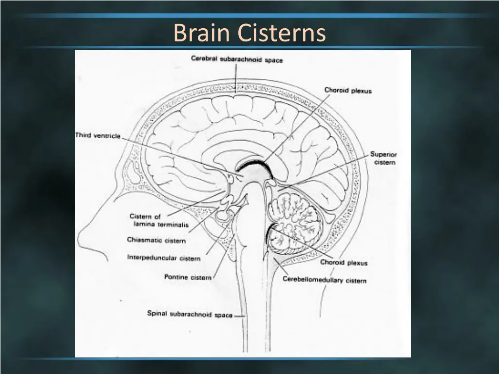 brain cisterns 3