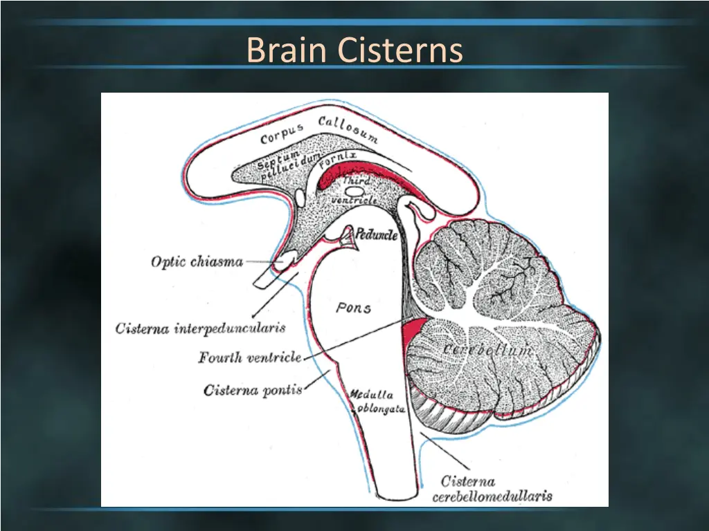 brain cisterns 4