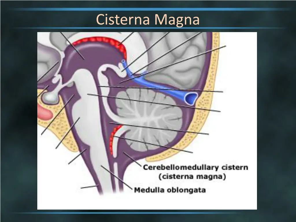 cisterna magna 1