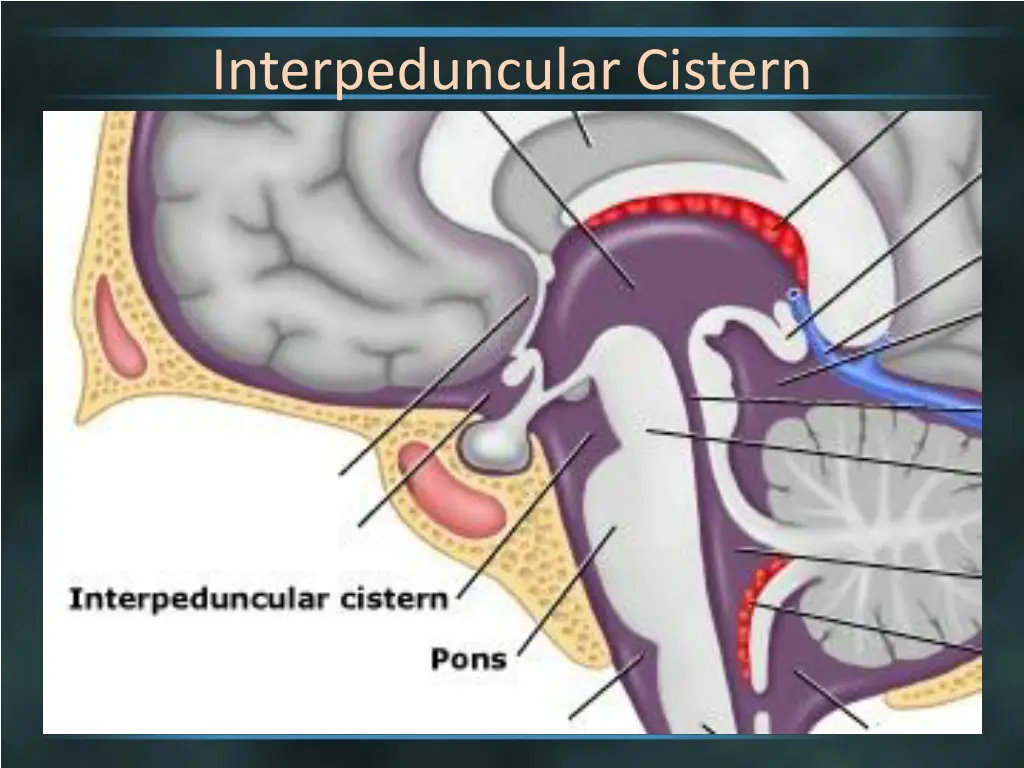 interpeduncular cistern 1