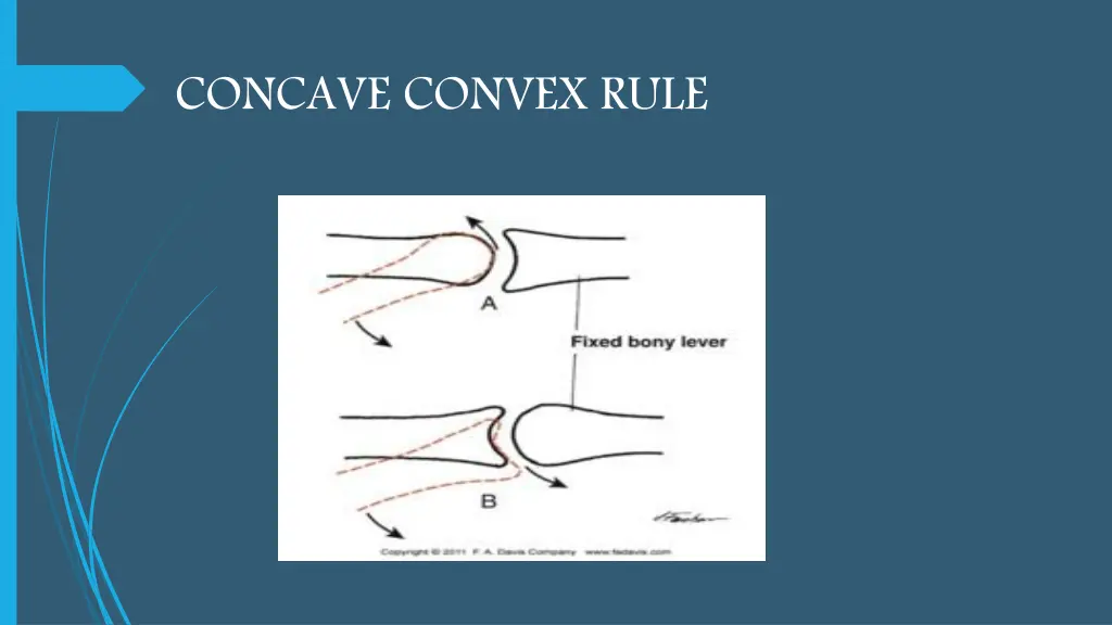 concave convex rule