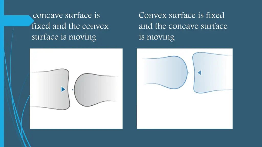 concave surface is fixed and the convex surface