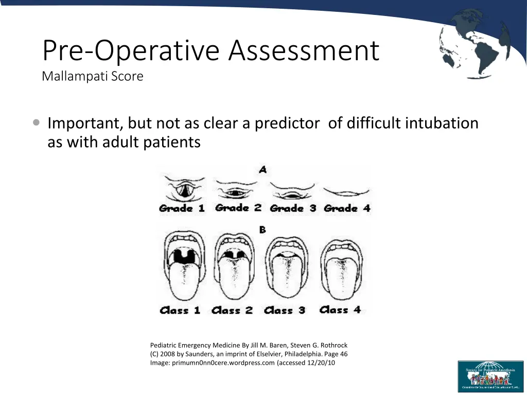 pre operative assessment mallampati score