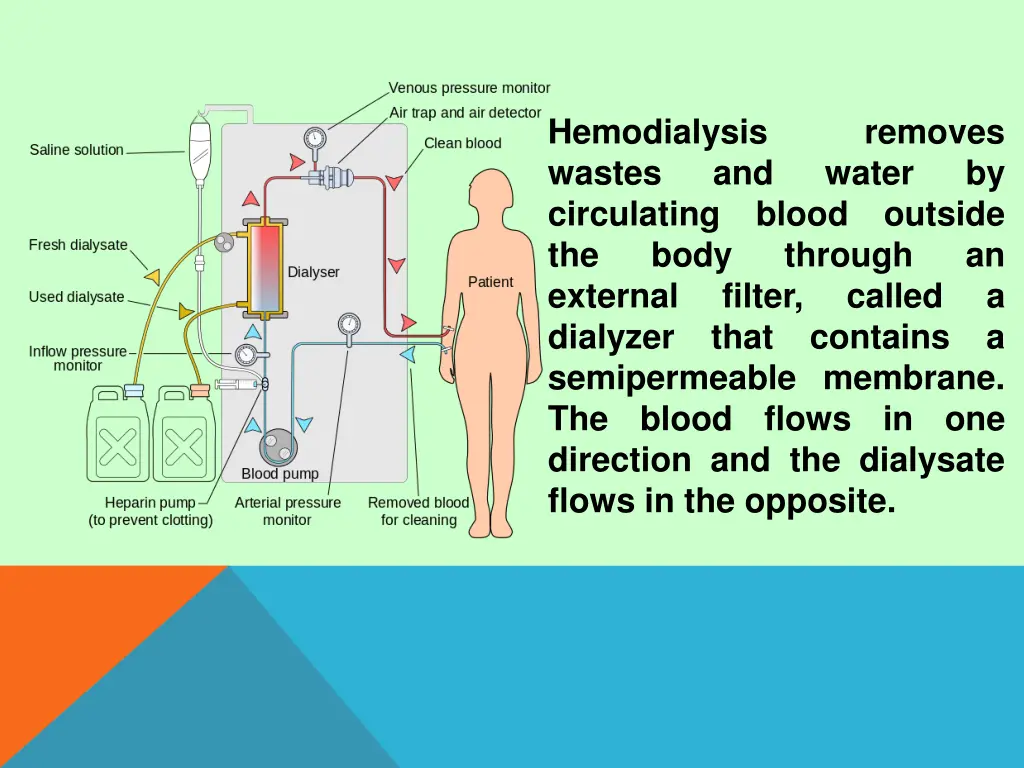 hemodialysis wastes circulating blood outside