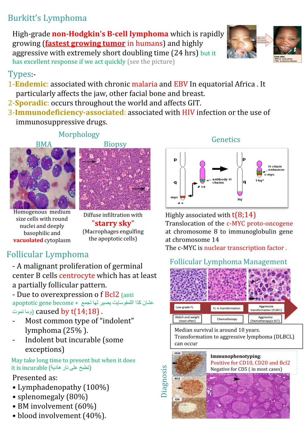 burkitt s lymphoma