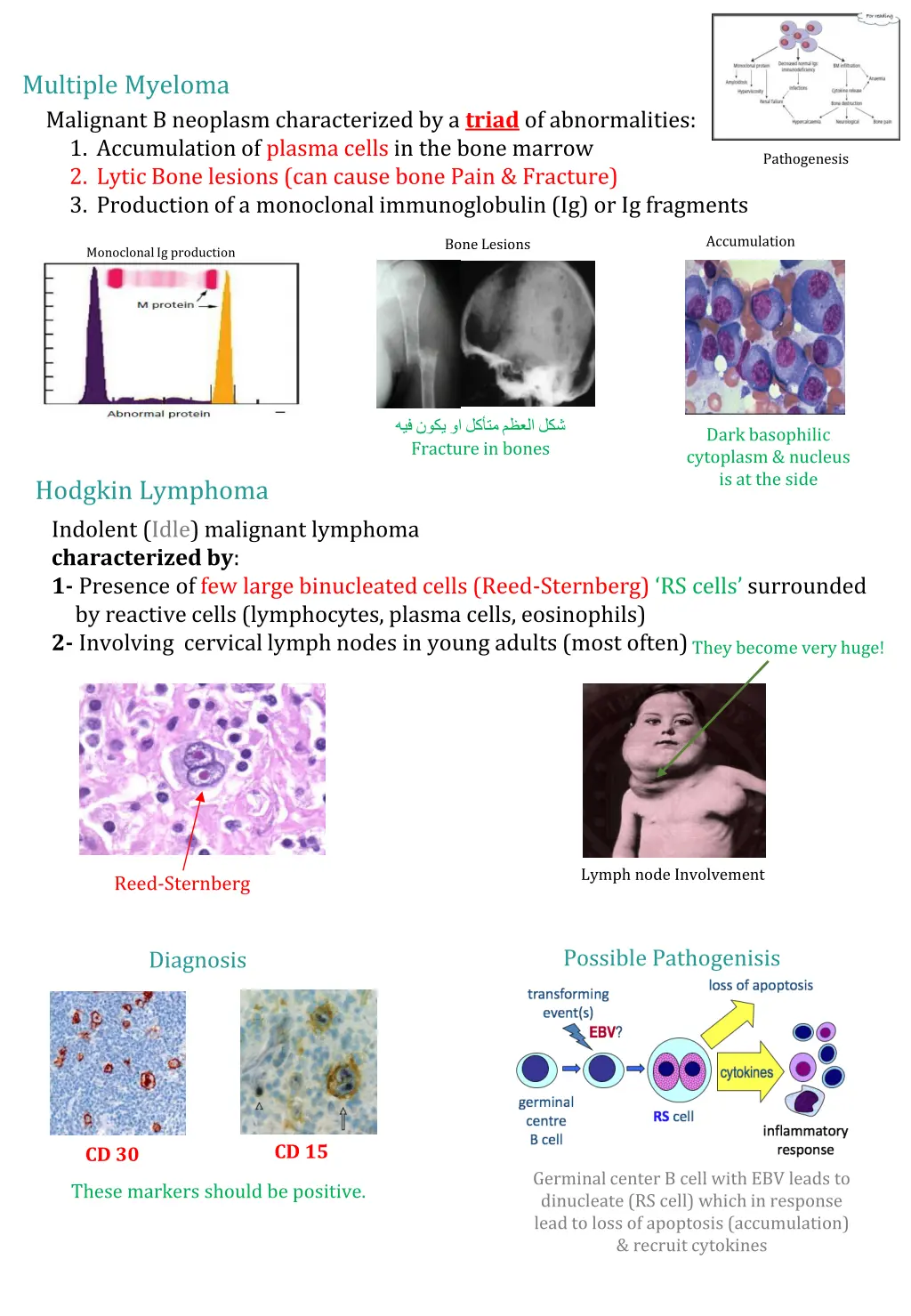 multiple myeloma malignant b neoplasm