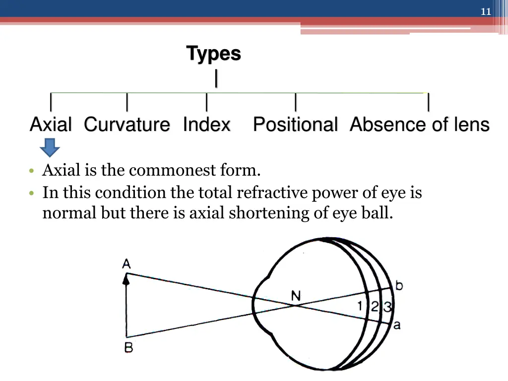 slide11