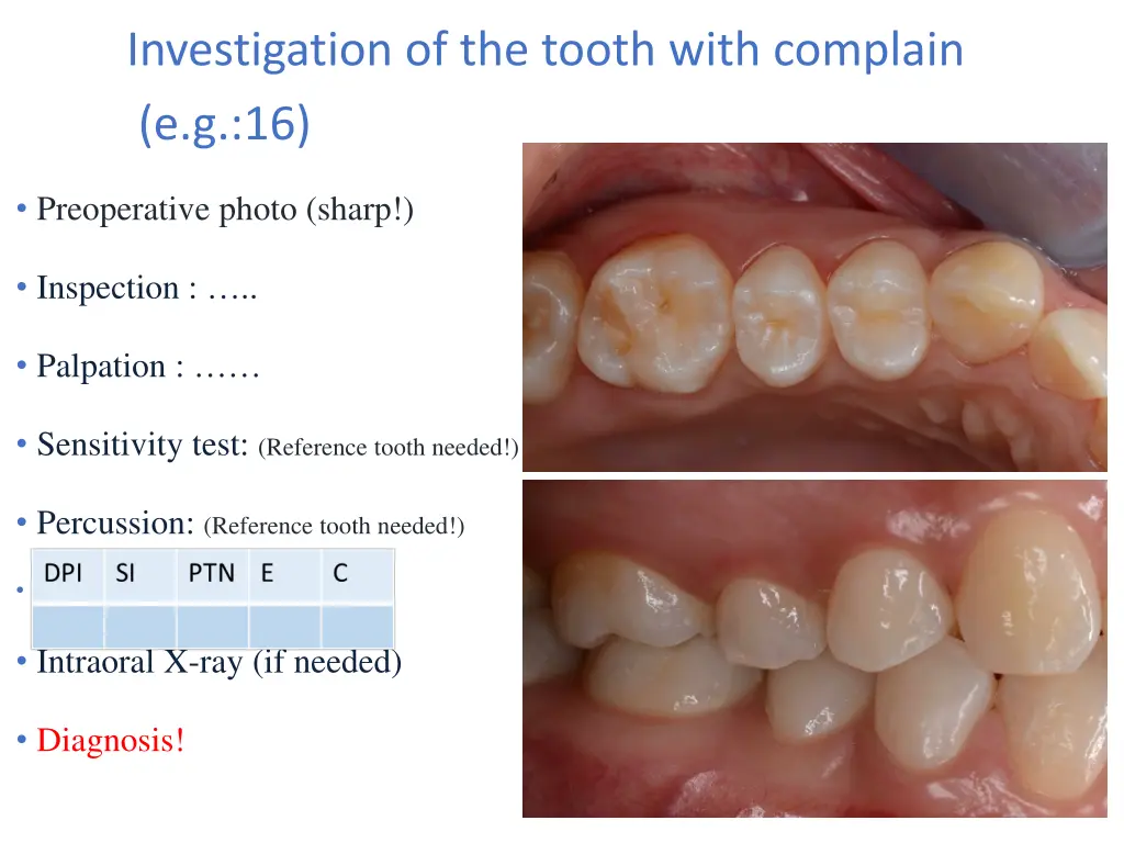 investigation of the tooth with complain e g 16