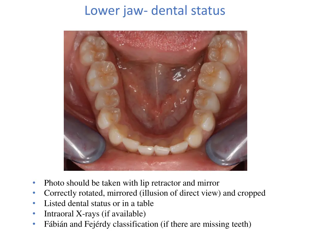 lower jaw dental status