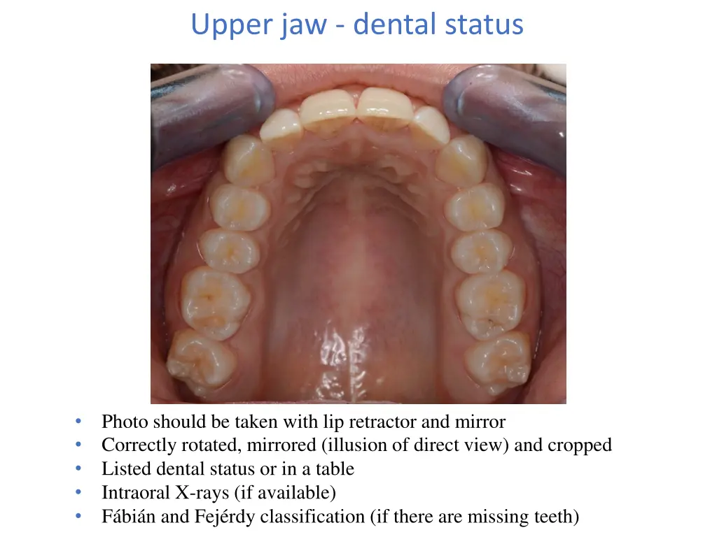 upper jaw dental status