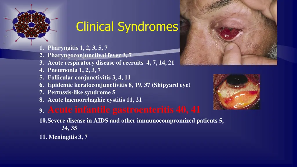 clinical syndromes