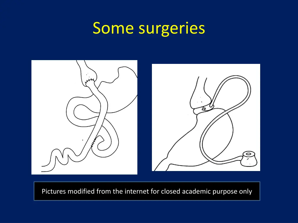 some surgeries