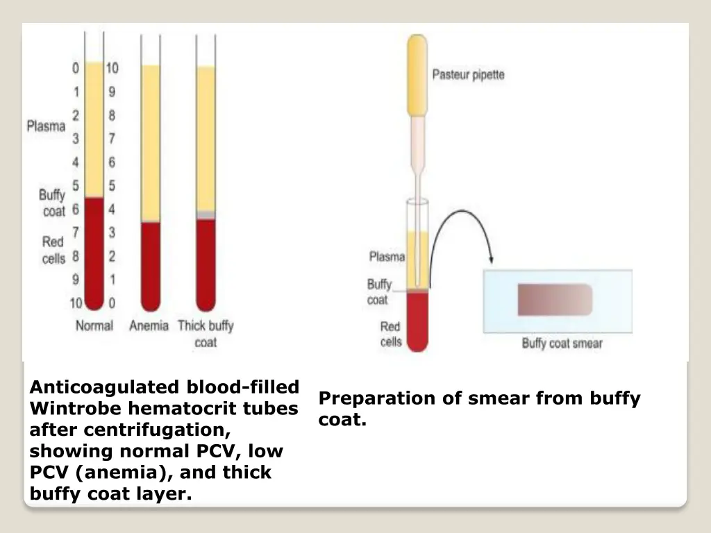 anticoagulated blood filled wintrobe hematocrit