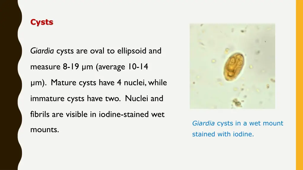 cysts