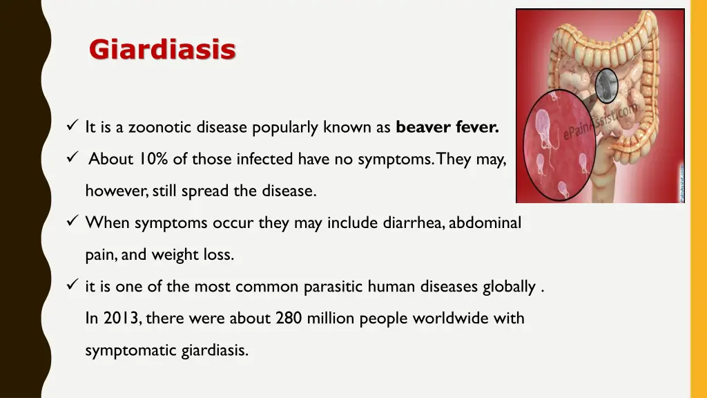 giardiasis