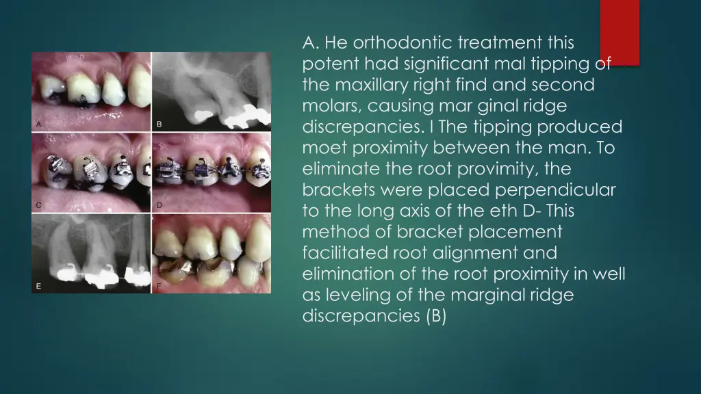 a he orthodontic treatment this potent