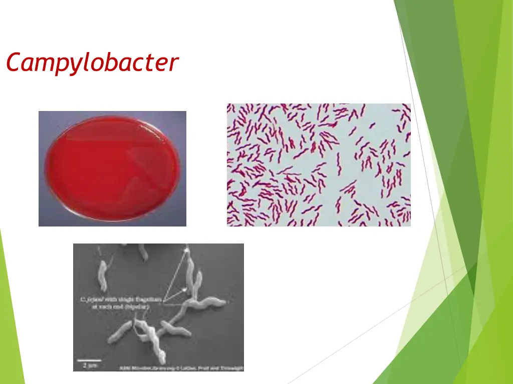 campylobacter 1