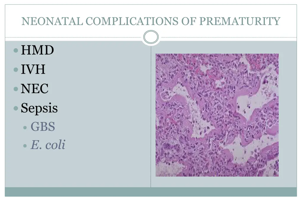 neonatal complications of prematurity