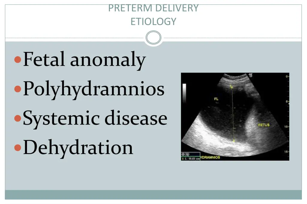 preterm delivery etiology 1