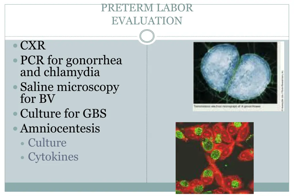 preterm labor evaluation 3