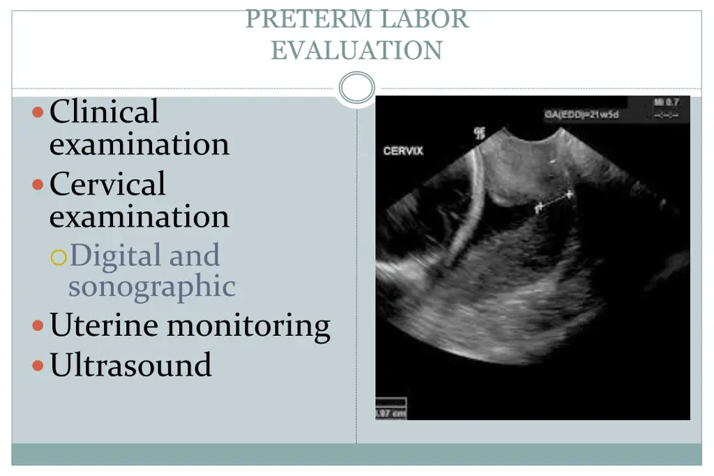 preterm labor evaluation