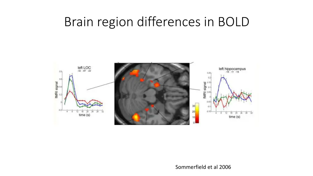 brain region differences in bold 2