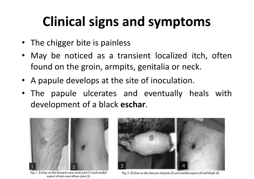 clinical signs and symptoms