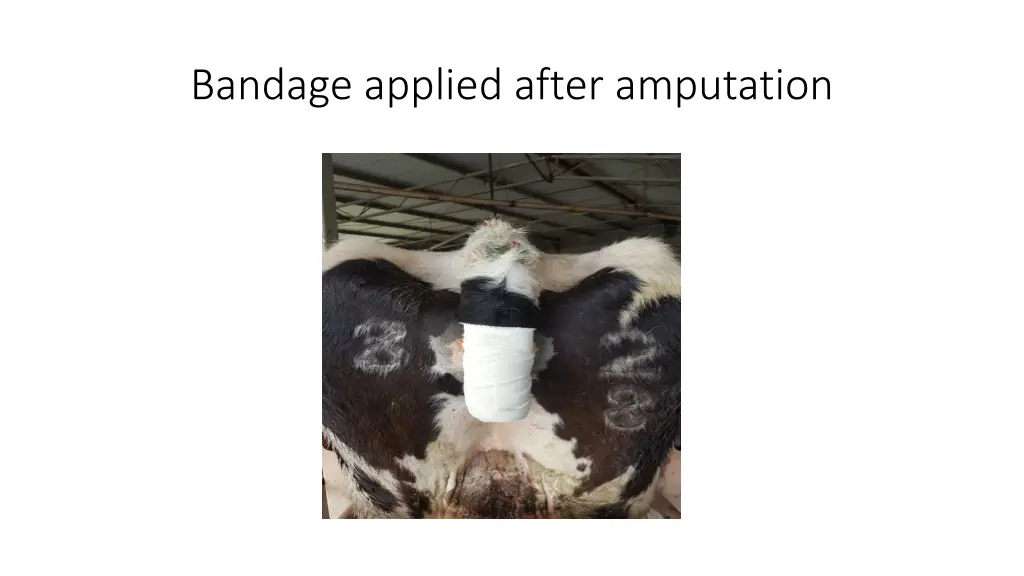 bandage applied after amputation