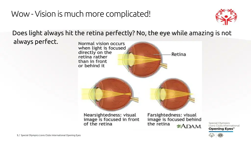 wow vision is much more complicated