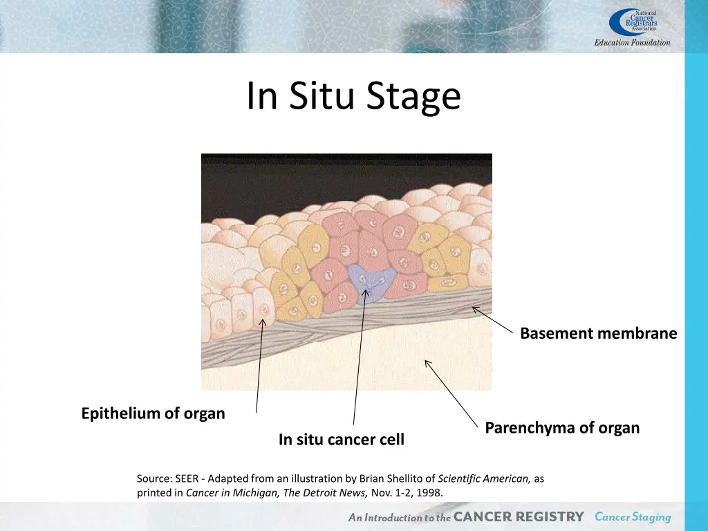 in situ stage