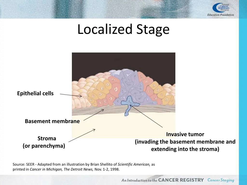 localized stage