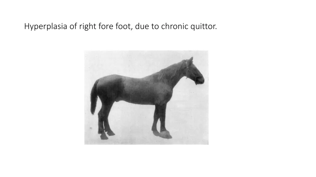 hyperplasia of right fore foot due to chronic