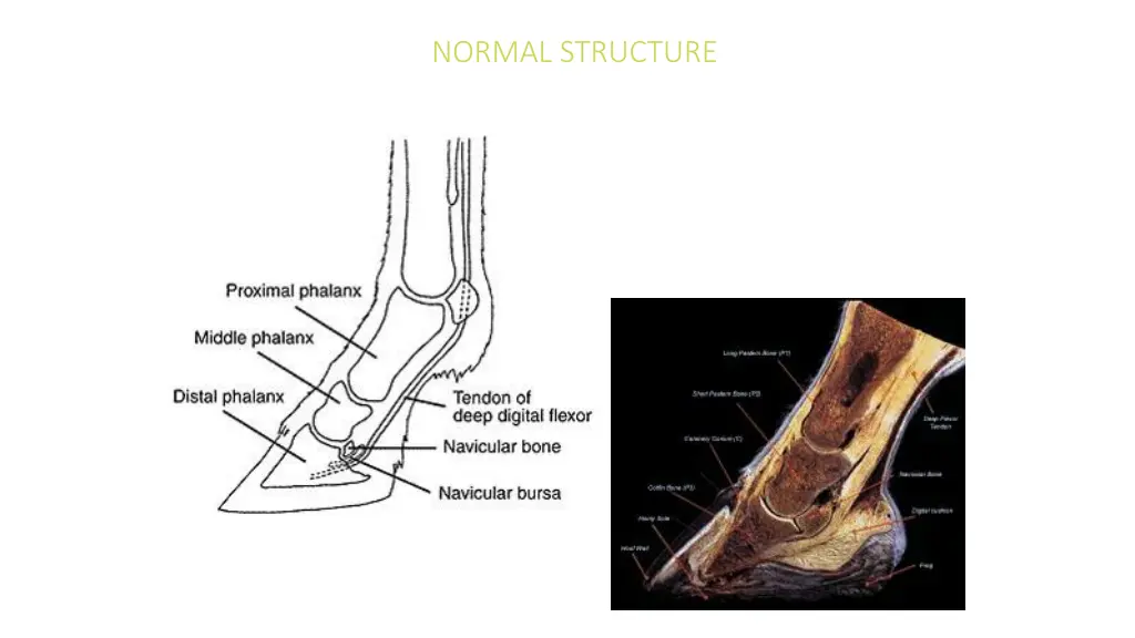 normal structure