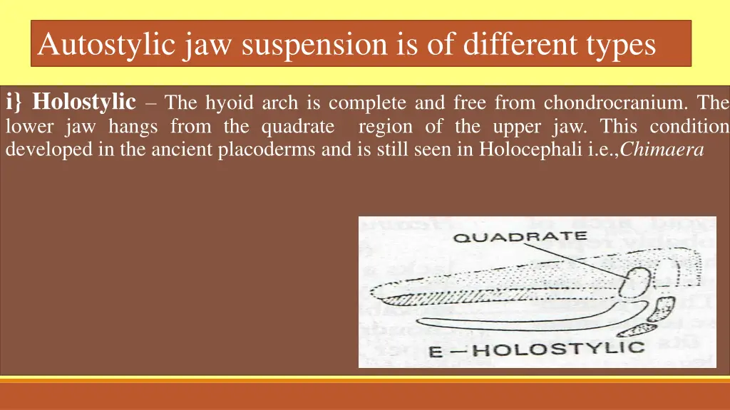 autostylic jaw suspension is of different types