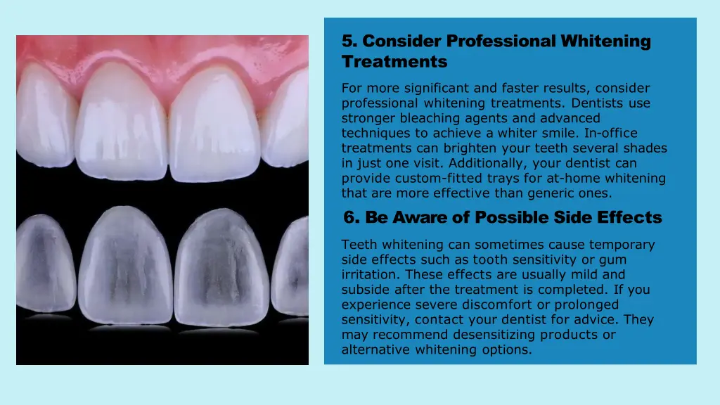 5 consider professional whitening treatments