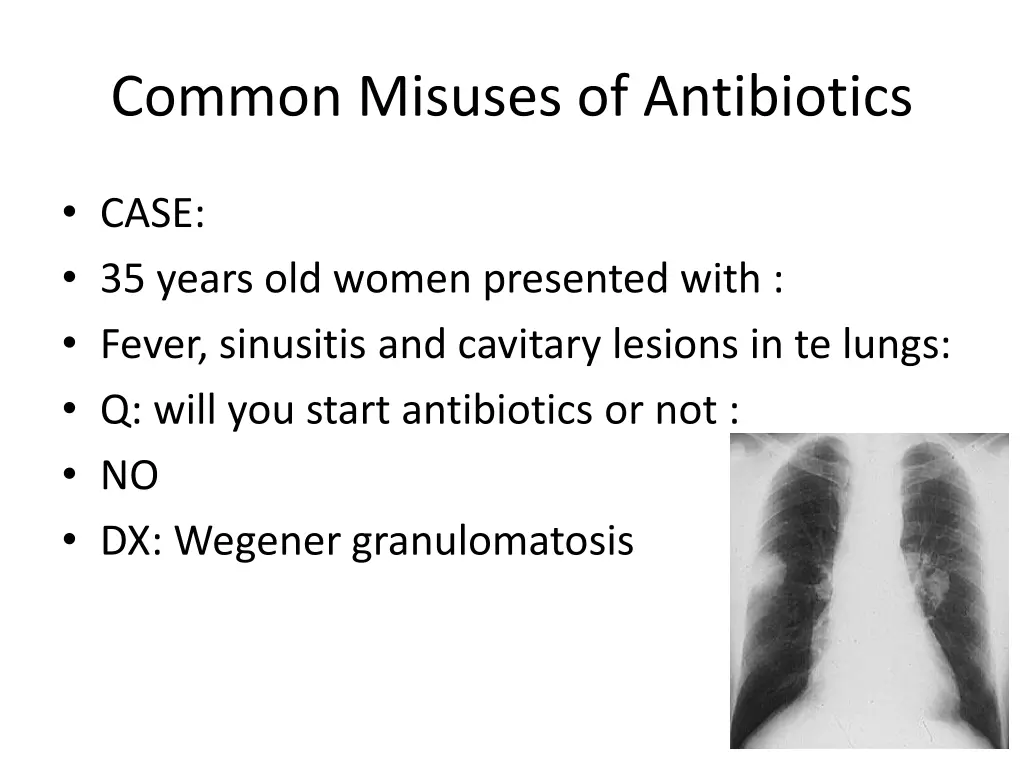 common misuses of antibiotics 1