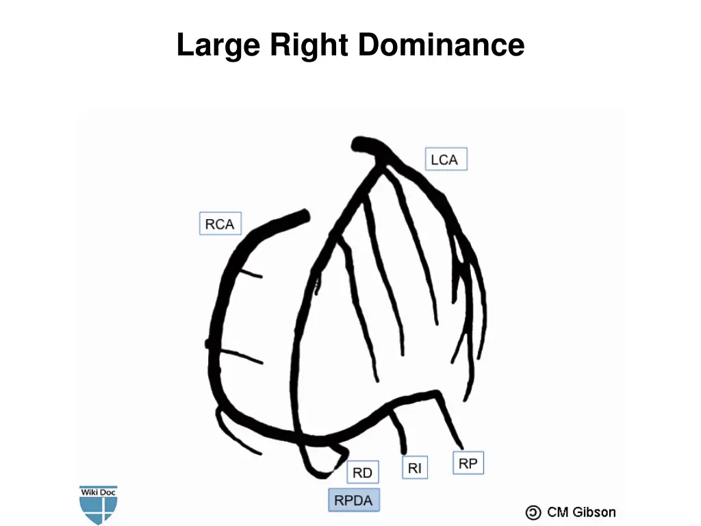 large right dominance