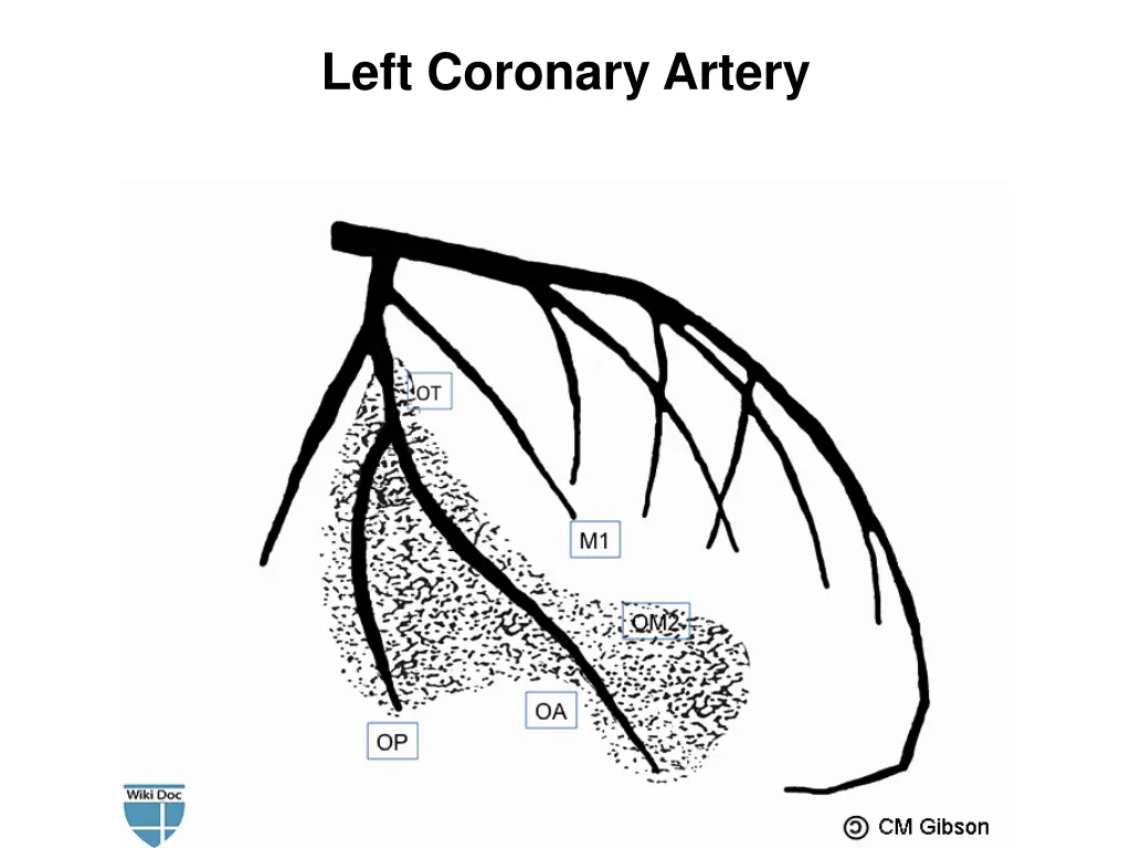 left coronary artery 1