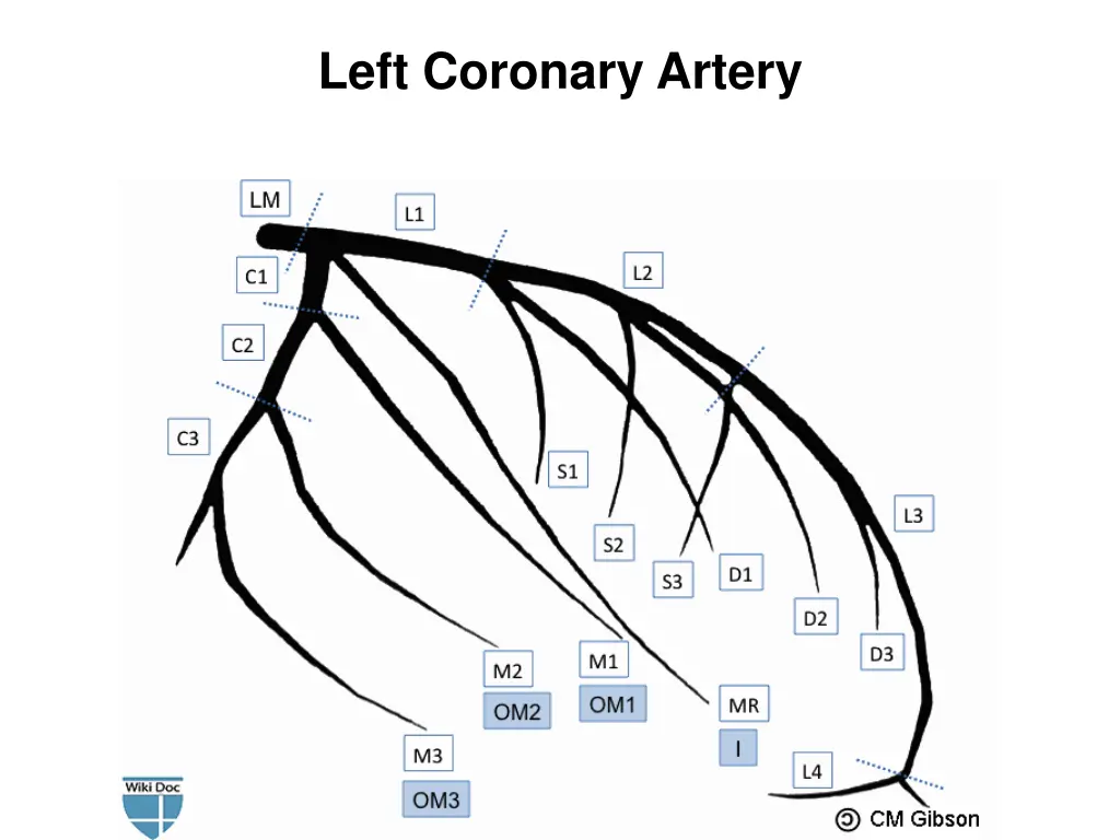 left coronary artery