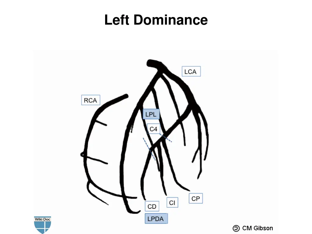 left dominance