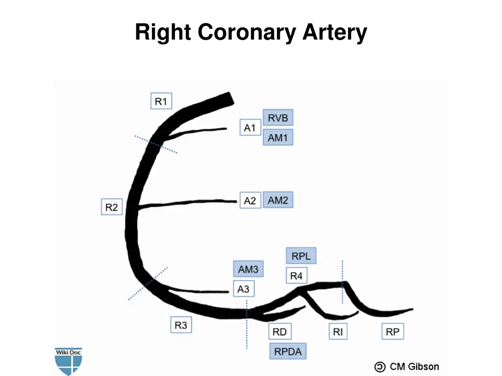 right coronary artery