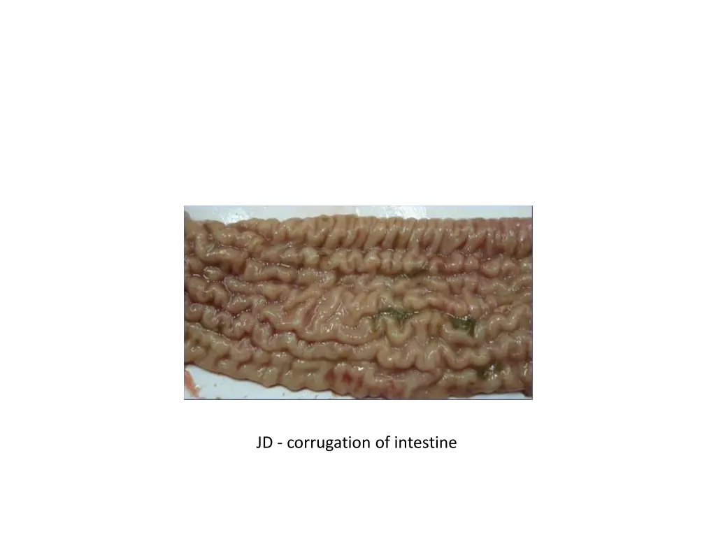 jd corrugation of intestine