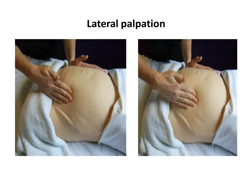 lateral palpation 1