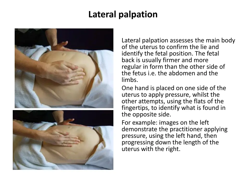 lateral palpation