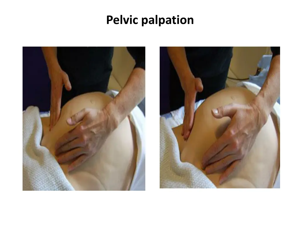 pelvic palpation 1