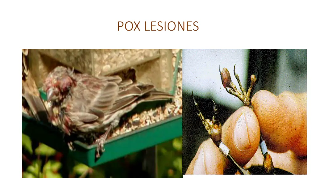 pox lesiones