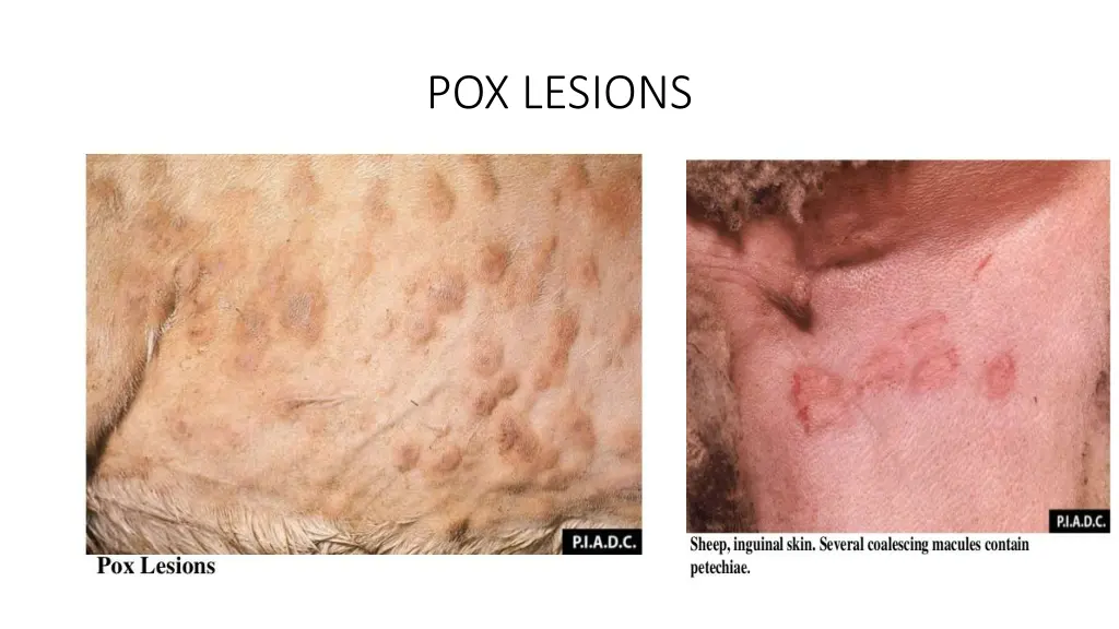 pox lesions 1