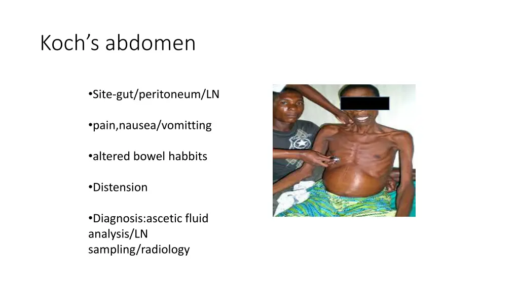 koch s abdomen