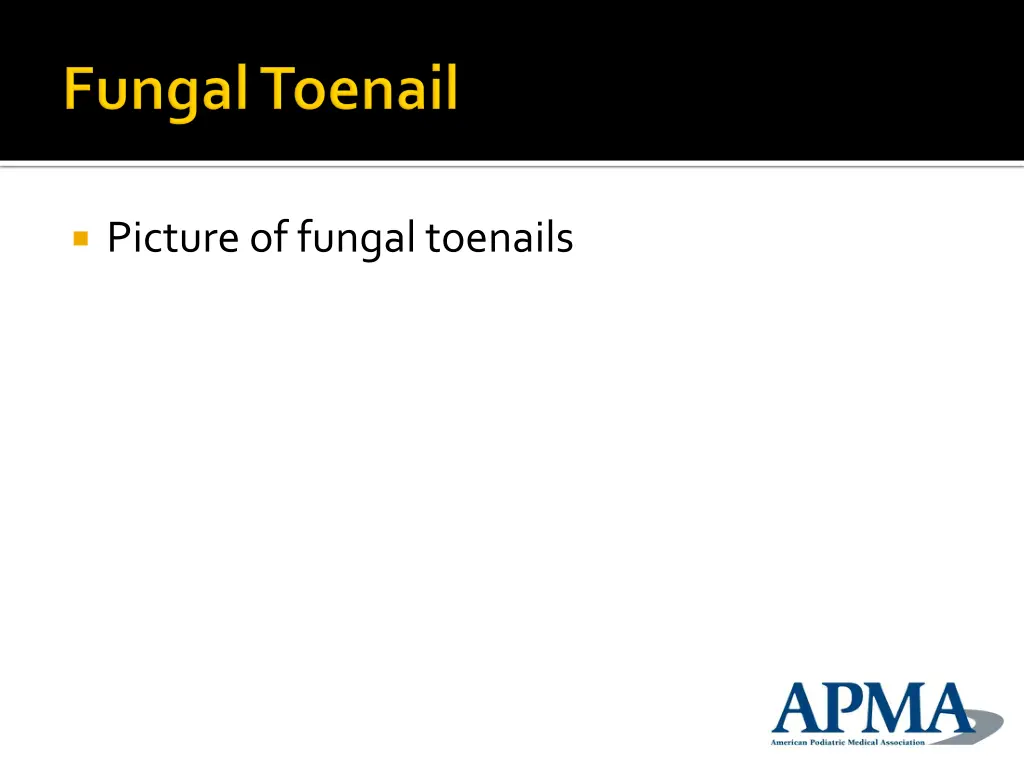 picture of fungal toenails